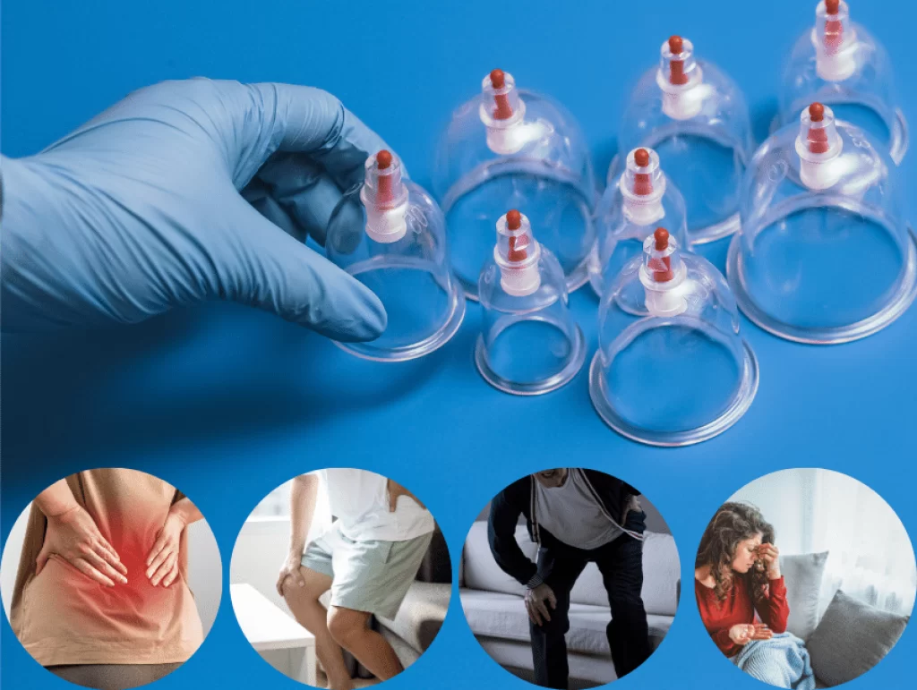 découvrez les bienfaits de la hijama et ses propriétés pour une protection naturelle de votre santé grâce à des méthodes traditionnelles et douces.